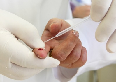UFPI e Fundação de Saúde realizam evento para teste rápido do HIV